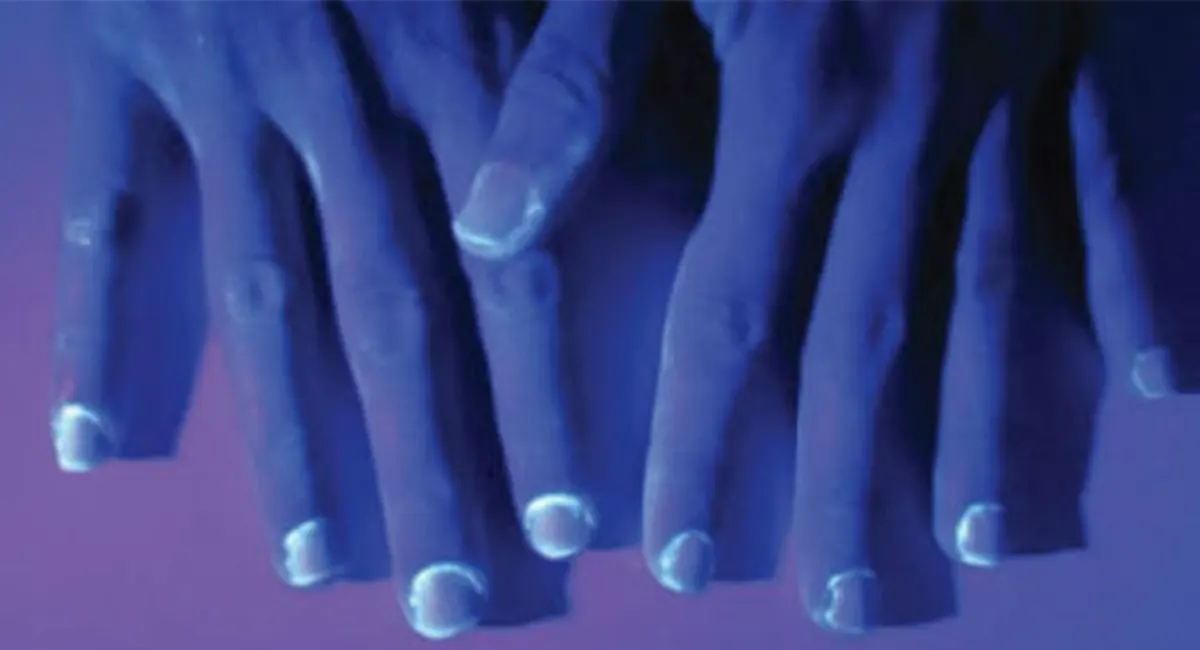 Germs stay alive on hands up to 3 hours