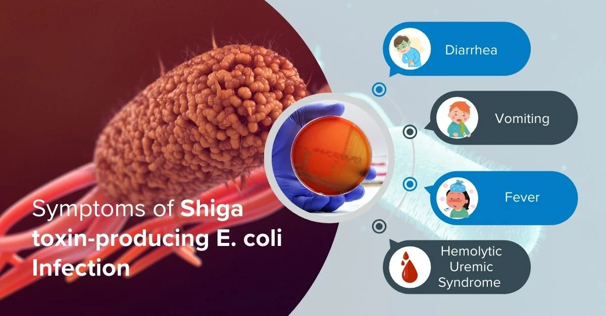 Symptoms of Shiga toxin-producing E. coli Infection