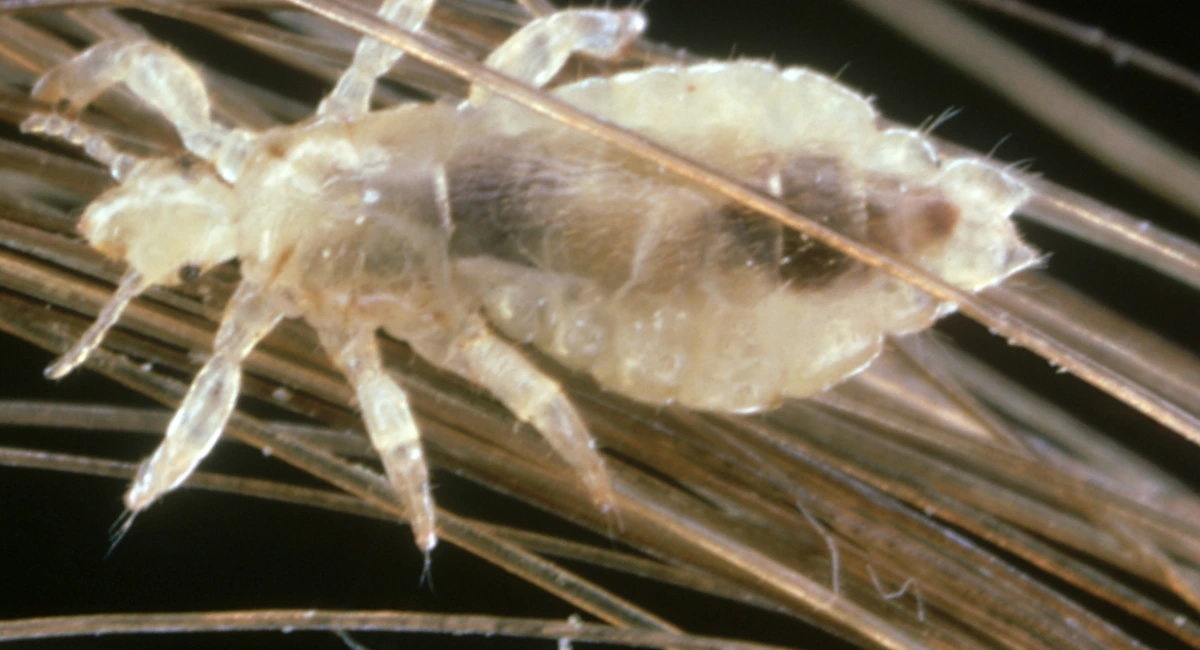 Infestation poux milieu scolaire