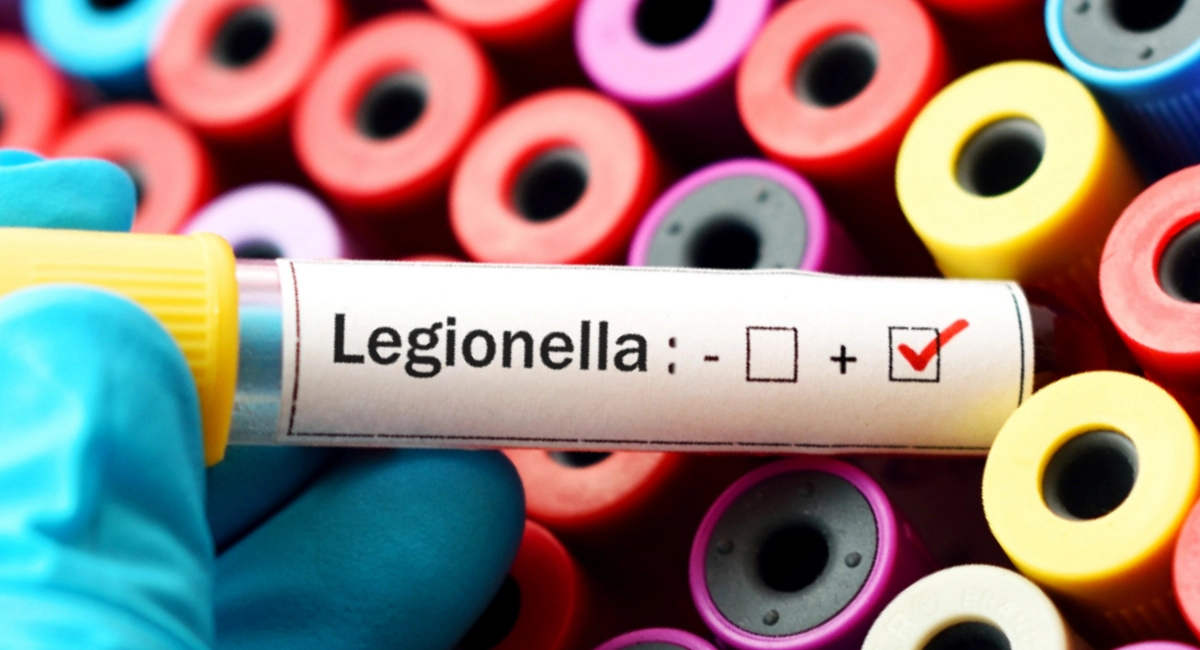 Legionella