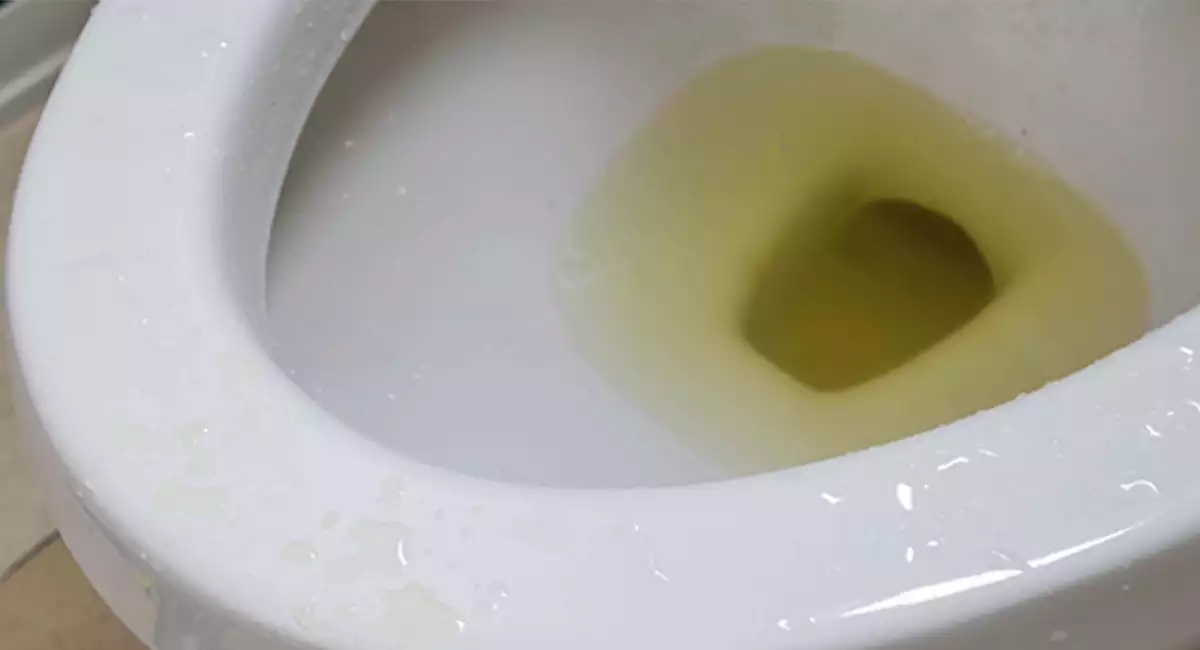 dirty toilet pee