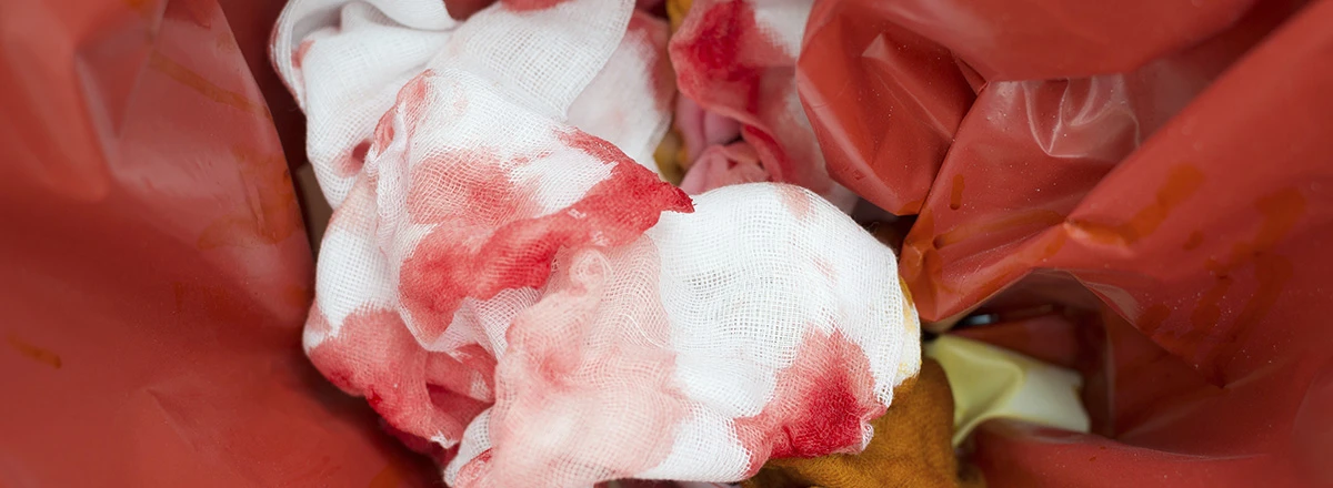 contaminated tissue